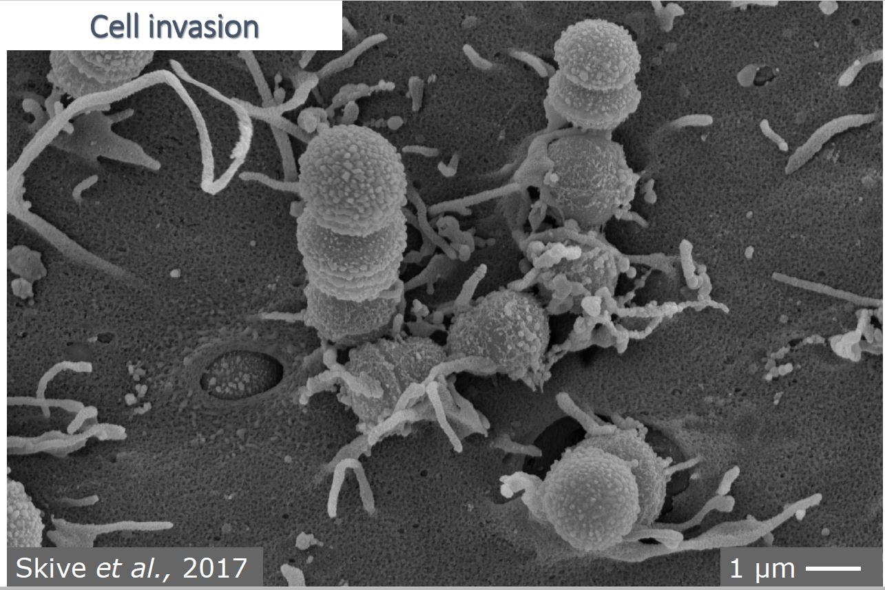 Streptokokken celinvasie onder de microscoop
